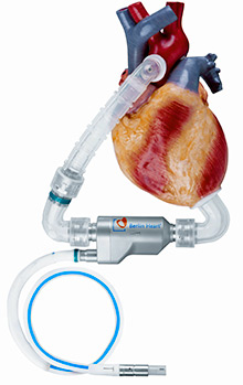 INCOR® Left Ventricular Assist Device