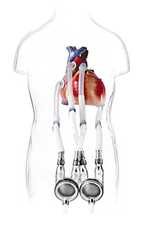 EXCOR® Ventricular Assist Devices